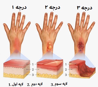 تصویر شاخص بیماری